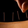 Acupuncture and Massage for immediate Pain relief