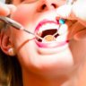 Free Dental Hygiene