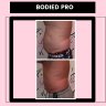 Body Contouring Services for Men & Women : Affordable and Effect